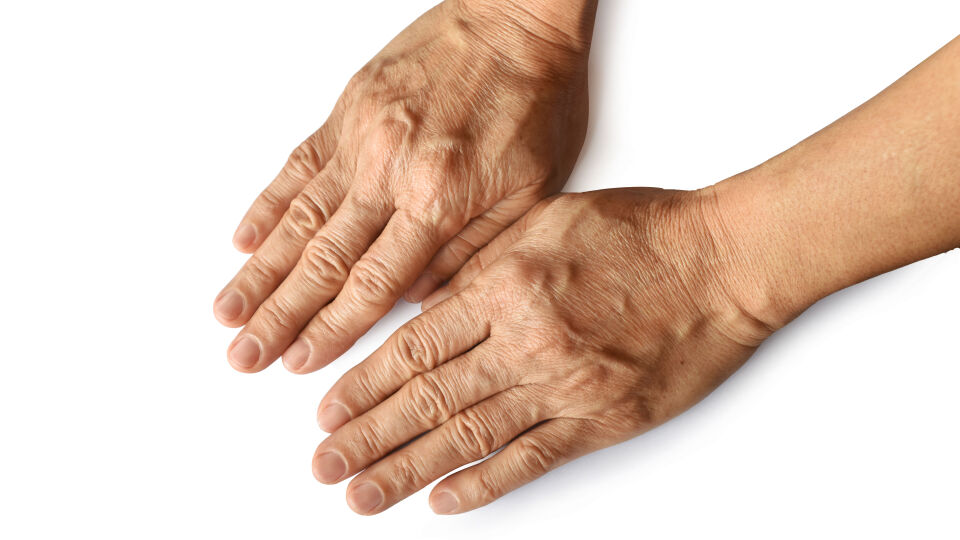 hände_shutterstock_1922454005 - Ohne Pflege- und Schutzmaßnahmen trocknet die Haut an den Händen schnell aus, altert beschleunigt und bildet frühzeitiger tiefe Falten aus. Typisch ist mit zunehmendem Alter zudem das Auftreten von Pigmentflecken, den sogenannten Altersflecken.