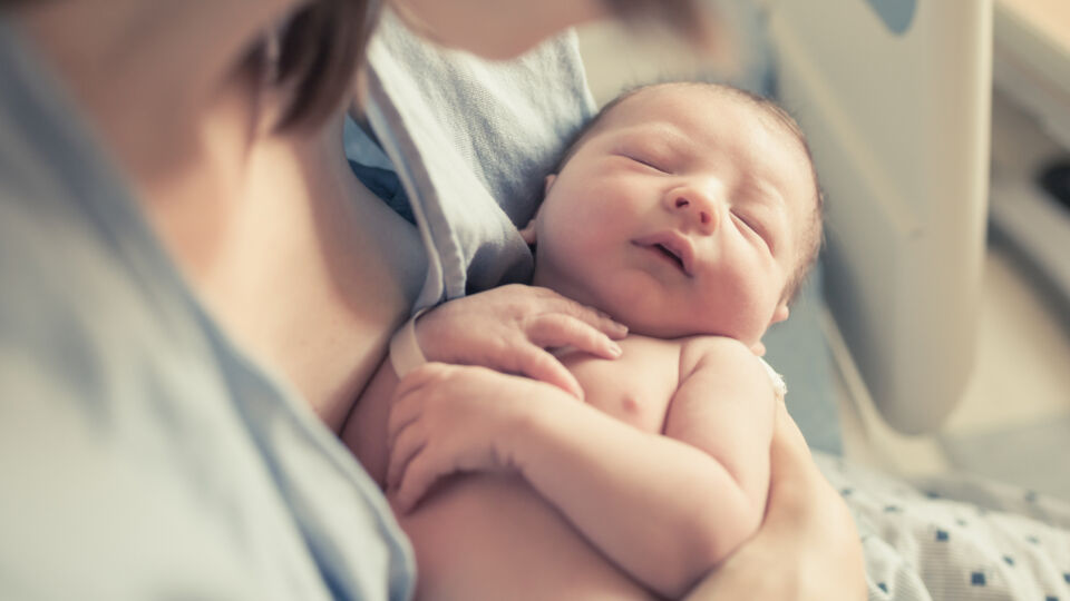 Baby newborn - Milchschorf kann eine erste Erscheinungsform von Neurodermitis sein. - © Shutterstock