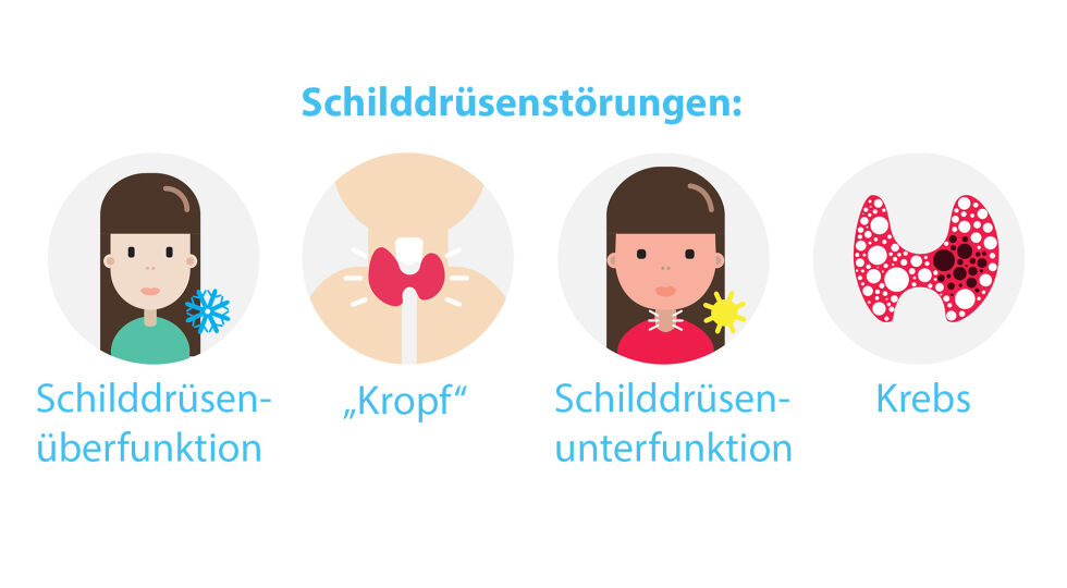 Schilddrüse deutsch - Mögliche Erkrankungen der Schilddrüse. - © Shutterstock/red