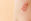 Gürtelrose_shutterstock_664501366 - Bei der Gürtelrose (Herpes zoster) bildet sich ein schmerzhafter streifenförmiger Hautausschlag mit Bläschen.
