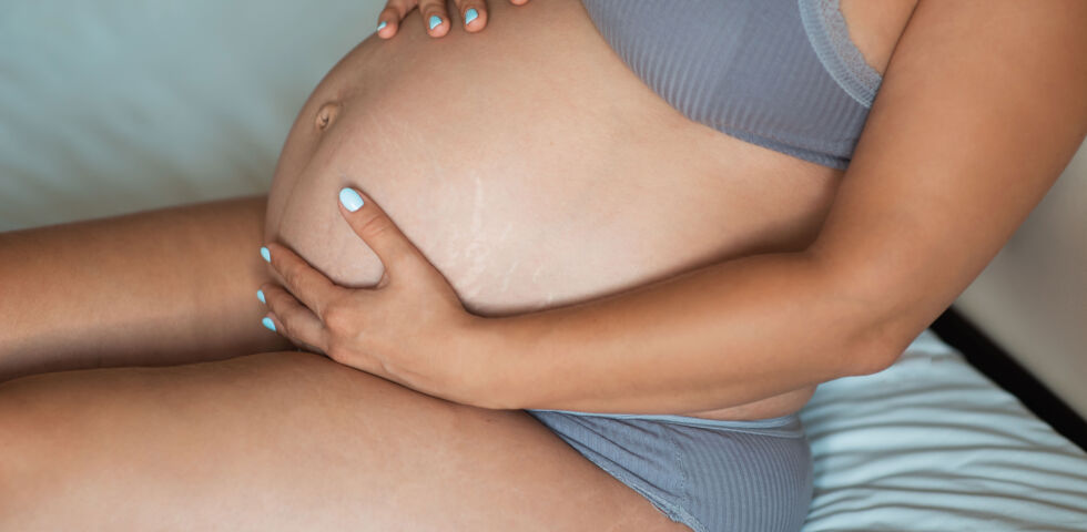 schwangerschaftsstreifen_shutterstock_2114237057 - Die meisten Schwangeren fürchten sich vor Dehnungssstreifen und möchten ihnen aktiv vorbeugen.